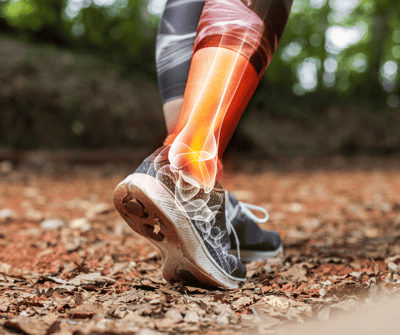 How to Treat a Sprained Ankle: A Physiotherapist's Guide